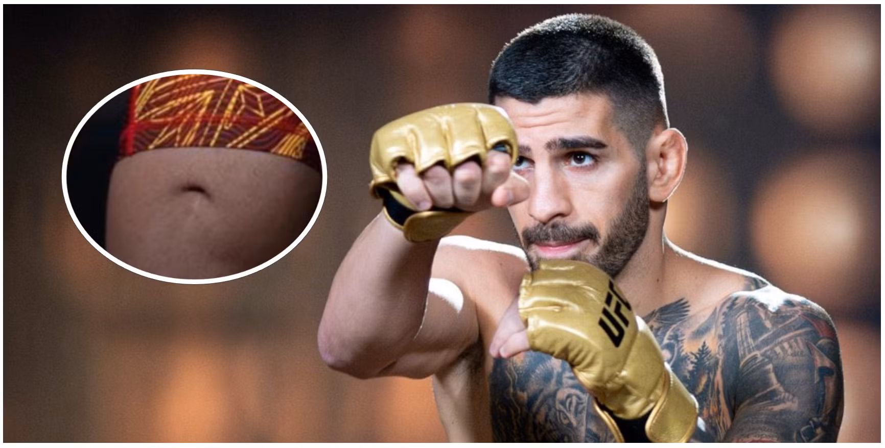 Why Ilia Topuria Has a Hole Above His Left Knee